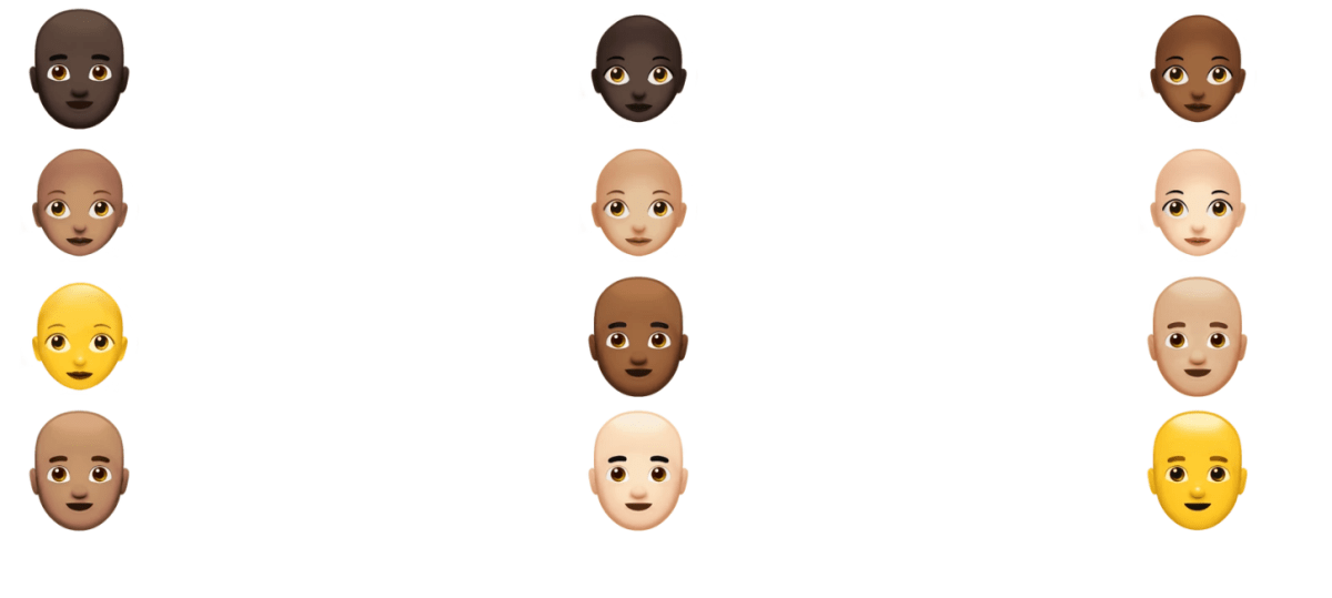 New AI Tool Diagnoses Hair Loss and Recommends Effective Treatments