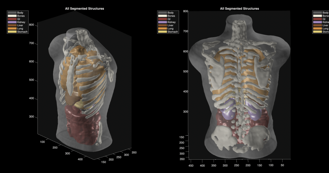 Midjourney Scanner ultrasound - Midjourney Expands Beyond AI Art with Full-Body Ultrasound Scanner
